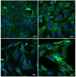 DDX6 Antibody, Novus Biologicals 0.1mL; Unlabeled:Antibodies, Polyclonal